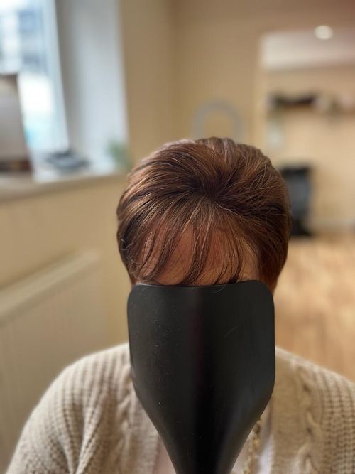 Hair Replacement Consultation & Treatment