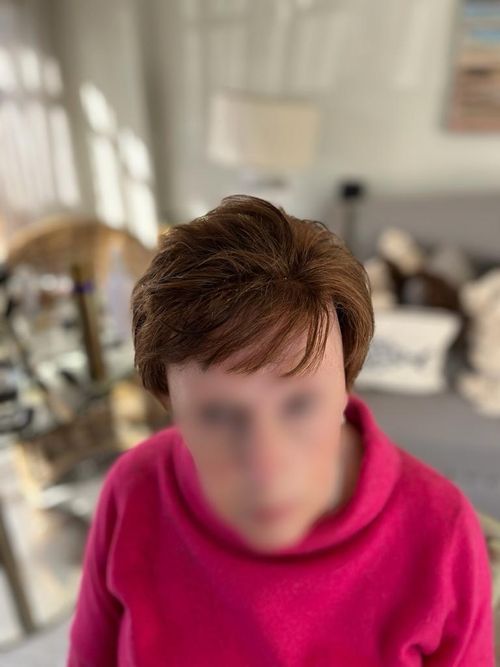 Hair replacement maintenance